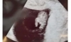 통닭을 임신한 여성